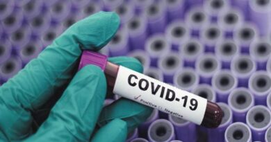 Θετικό κρούσμα Covid 19 στην εθνική ανδρών! Θετικό κρούσμα Covid 19 στην εθνική ανδρών!